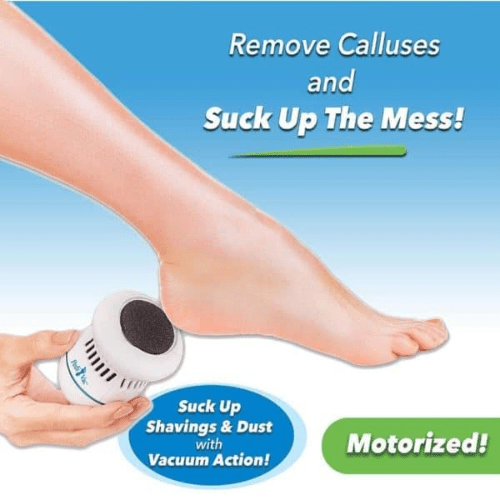 Electric Pedivac-Remove Your Callus Easily - lockandclock