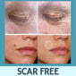 Skin Care Face Tag Remover Patch - lockandclock