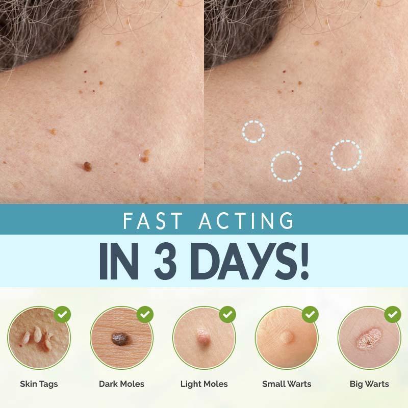 Skin Care Face Tag Remover Patch - lockandclock