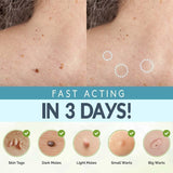Skin Care Face Tag Remover Patch - lockandclock
