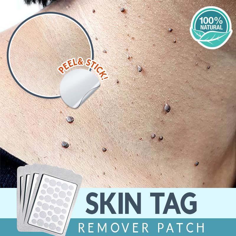 Skin Care Face Tag Remover Patch - lockandclock