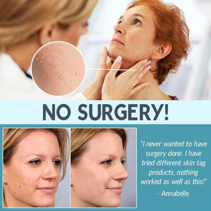 Skin Care Face Tag Remover Patch - lockandclock