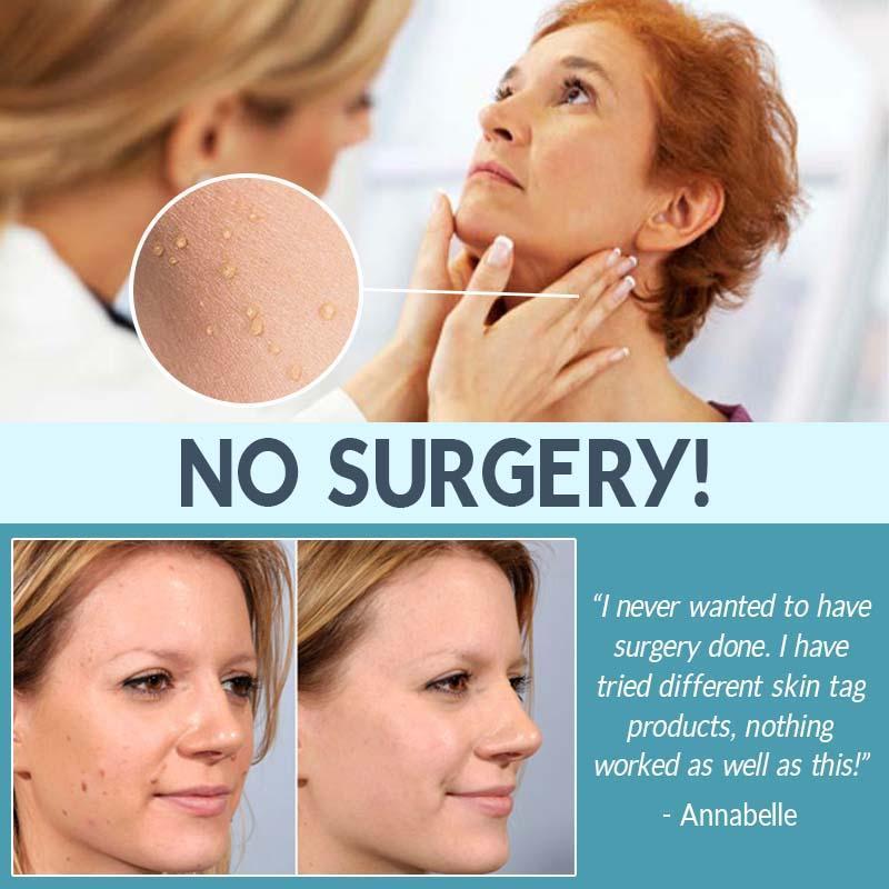 Skin Care Face Tag Remover Patch - lockandclock
