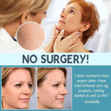 Skin Care Face Tag Remover Patch - lockandclock