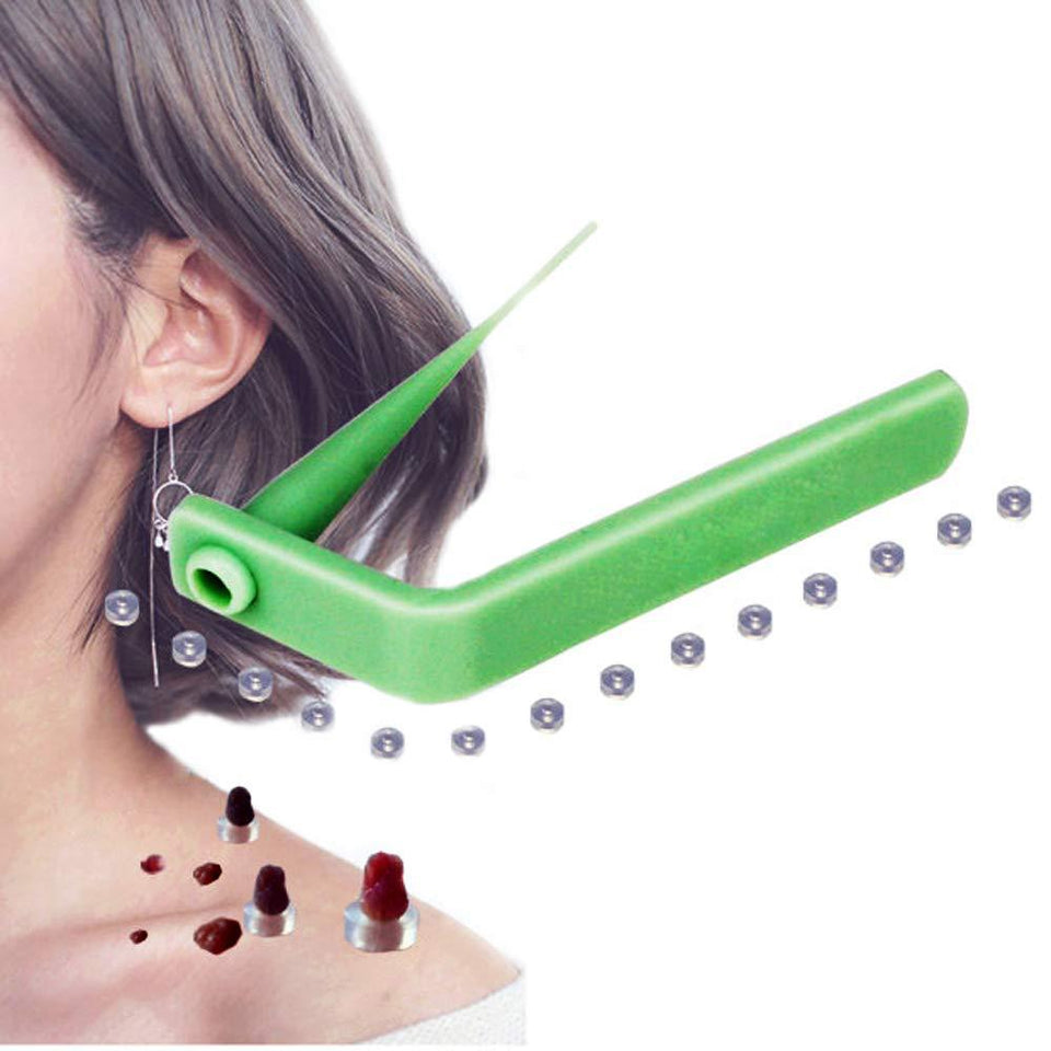 Skin Tag Remover Kit For Home Use - lockandclock